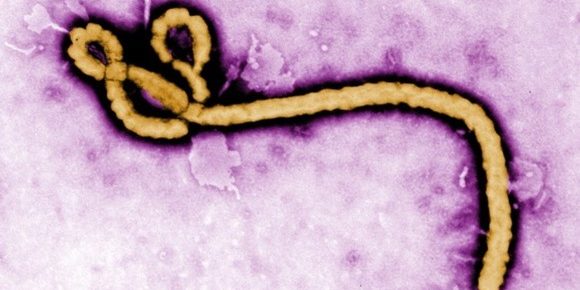 Ebola